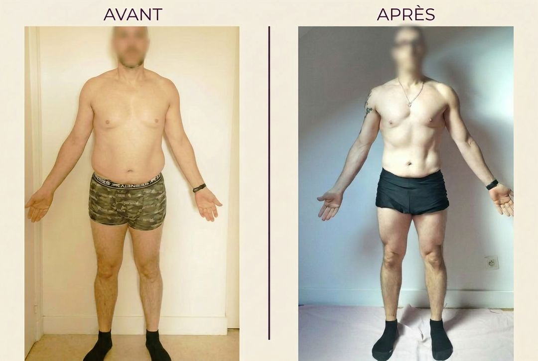 David — montage avant / après